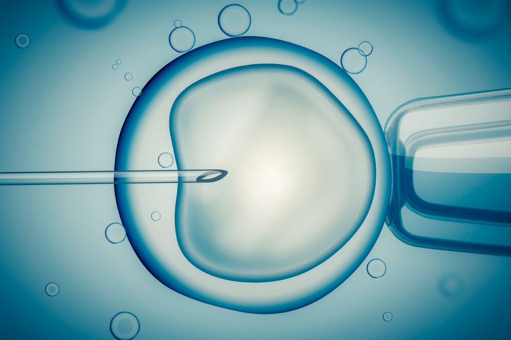 clínicas especializadas en fecundación in vitro de Toledo - ovulo