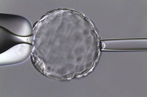 biopsia