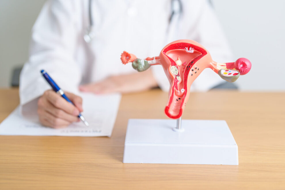 Como-afecta-la-endometriosis-a-la-fertilidad-de-la-mujer